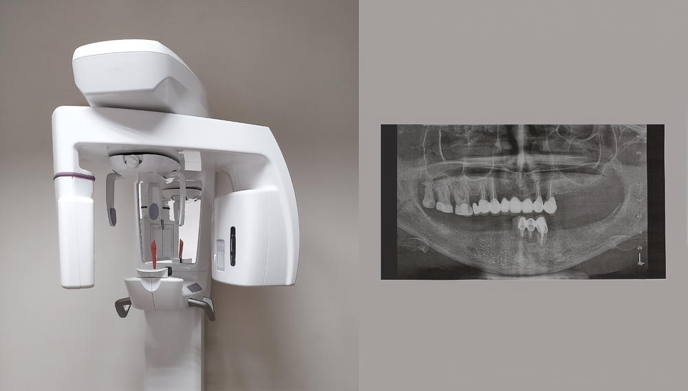 Maximizing Small Spaces: Smart Dental Office Design Solutions